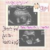 Baby Sonogram